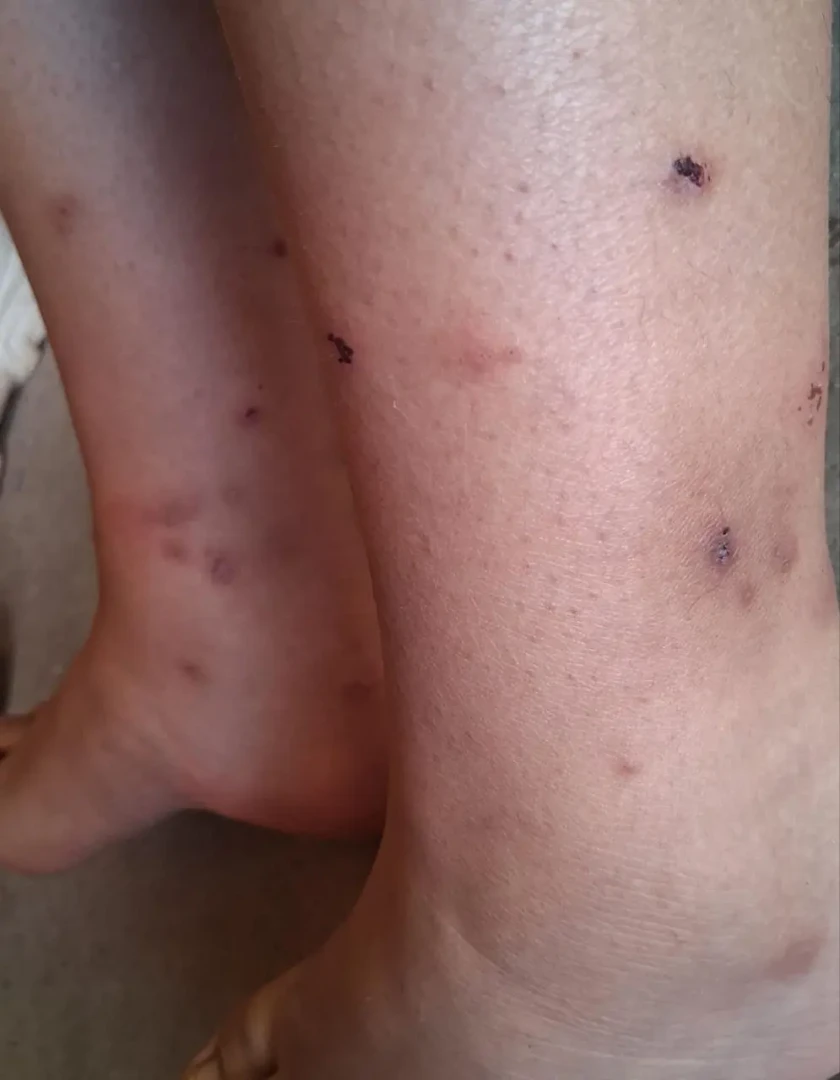 San Román: Cabana rechaza alimentos de Wasi Mikuna por dudas sobre calidad y falta de respuestas